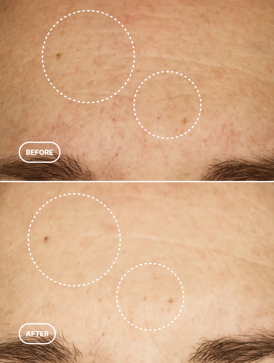 Natural Retinol Alternatives: What They Are and Do They Actually Work?