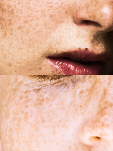 The 5 Skin Types, Explained (and Why Sensitivity Changes the Rules for All of Them)