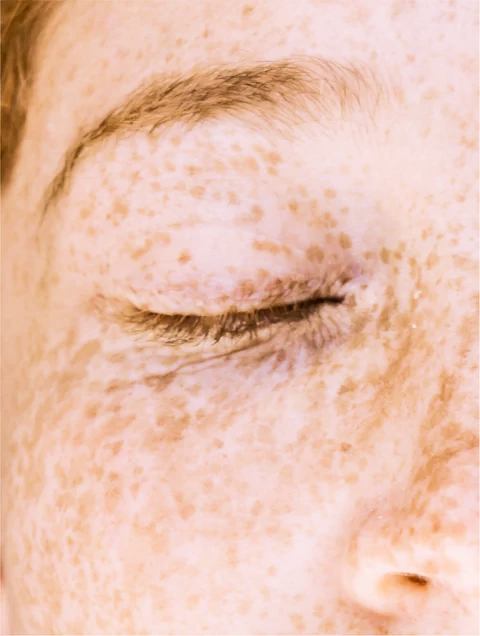 Targeted Dark Spot Care
